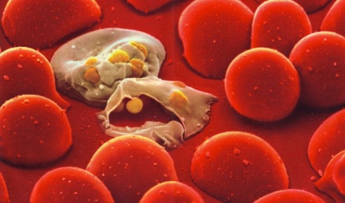эритроцит-при-малярии