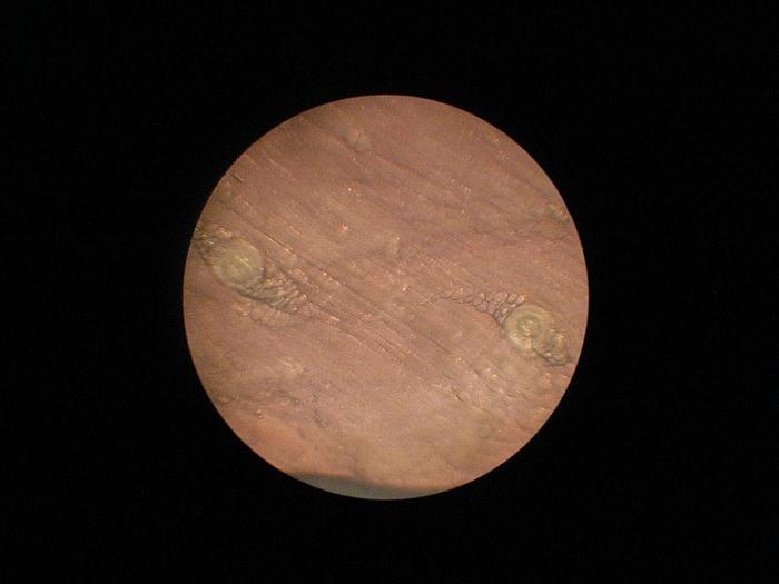 trichinella-under-microscope